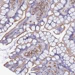 MIC-1 Antibody in Immunohistochemistry (Paraffin) (IHC (P))