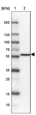 MIC-1 Antibody in Western Blot (WB)
