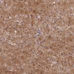 SLC25A41 Polyclonal Antibody