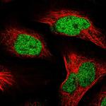 CT112 Polyclonal Antibody