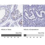 CT112 Antibody in Immunohistochemistry (IHC)
