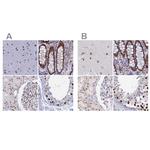 CT112 Antibody in Immunohistochemistry (IHC)