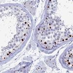 CT112 Antibody in Immunohistochemistry (IHC)