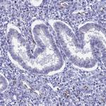 CT112 Antibody in Immunohistochemistry (IHC)
