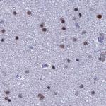 CT112 Antibody in Immunohistochemistry (IHC)