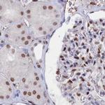 CT112 Antibody in Immunohistochemistry (IHC)