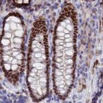 CT112 Antibody in Immunohistochemistry (IHC)