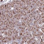 HS2ST1 Polyclonal Antibody