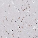 GPATCH1 Antibody in Immunohistochemistry (Paraffin) (IHC (P))