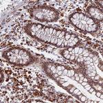 GPATCH1 Antibody in Immunohistochemistry (Paraffin) (IHC (P))