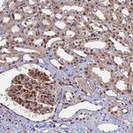 GPATCH1 Antibody in Immunohistochemistry (Paraffin) (IHC (P))