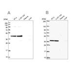 CCDC94 Antibody in Western Blot (WB)
