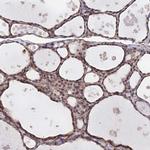 PAGR1 Polyclonal Antibody