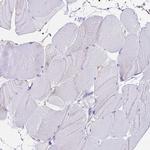 CCDC19 Antibody in Immunohistochemistry (Paraffin) (IHC (P))