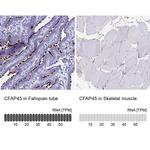 CCDC19 Antibody in Immunohistochemistry (IHC)
