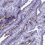 CCDC19 Antibody in Immunohistochemistry (IHC)