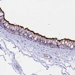 CCDC19 Antibody in Immunohistochemistry (IHC)