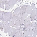 CCDC19 Antibody in Immunohistochemistry (IHC)