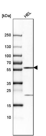 CCDC19 Antibody in Western Blot (WB)
