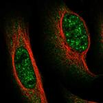 FAM160B1 Polyclonal Antibody