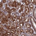 FAM160B1 Antibody in Immunohistochemistry (Paraffin) (IHC (P))