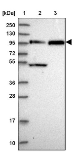 FAM160B1 Antibody in Western Blot (WB)