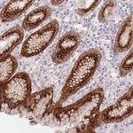 LOH12CR1 Polyclonal Antibody