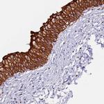 DEN2D Polyclonal Antibody