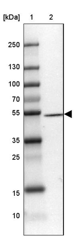 DEN2D Antibody in Western Blot (WB)