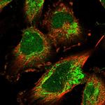 EARS2 Polyclonal Antibody