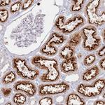 PKD2L2 Polyclonal Antibody