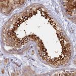 WDR62 Polyclonal Antibody