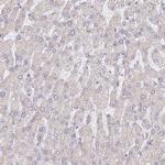 WDR62 Antibody in Immunohistochemistry (IHC)