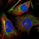 DNAJC16 Polyclonal Antibody