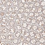 DNAJC16 Antibody in Immunohistochemistry (Paraffin) (IHC (P))