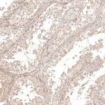 DNAJC16 Antibody in Immunohistochemistry (Paraffin) (IHC (P))