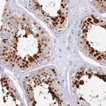 SNX20 Antibody in Immunohistochemistry (Paraffin) (IHC (P))