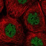 SNX20 Polyclonal Antibody