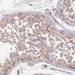 GNG5 Antibody in Immunohistochemistry (Paraffin) (IHC (P))