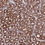 MRPL1 Antibody in Immunohistochemistry (Paraffin) (IHC (P))