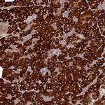 C8orf44 Antibody in Immunohistochemistry (Paraffin) (IHC (P))