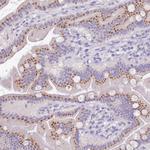 B3GNT8 Polyclonal Antibody