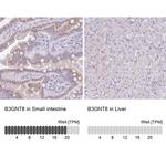B3GNT8 Antibody