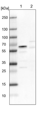 RBM42 Antibody in Western Blot (WB)