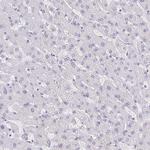 COL17A1 Antibody in Immunohistochemistry (Paraffin) (IHC (P))