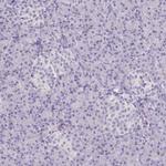 COL17A1 Antibody in Immunohistochemistry (Paraffin) (IHC (P))