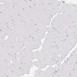 COL17A1 Antibody in Immunohistochemistry (IHC)