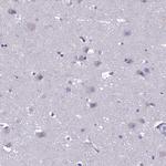 CRB2 Antibody in Immunohistochemistry (Paraffin) (IHC (P))