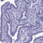 CRB2 Polyclonal Antibody