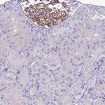 CRB2 Antibody in Immunohistochemistry (Paraffin) (IHC (P))